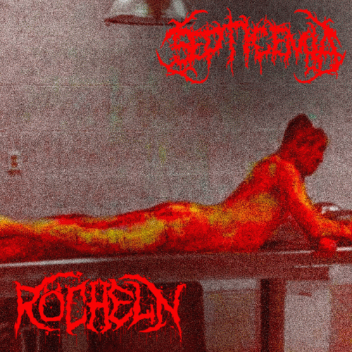 Röcheln : Röcheln - Septicemia Röcheln : Röcheln - Septicemia